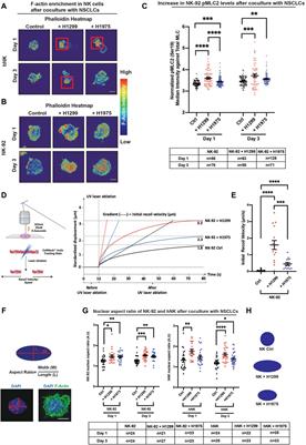 Lung Cancer Induces NK Cell Contractility and Cytotoxicity Through Transcription Factor Nuclear Localization